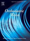 Orthodontic Waves