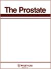 Prostate