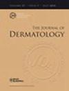 Journal of Dermatology