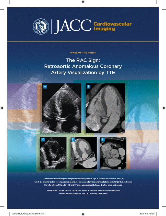 JACC. Cardiovascular imaging