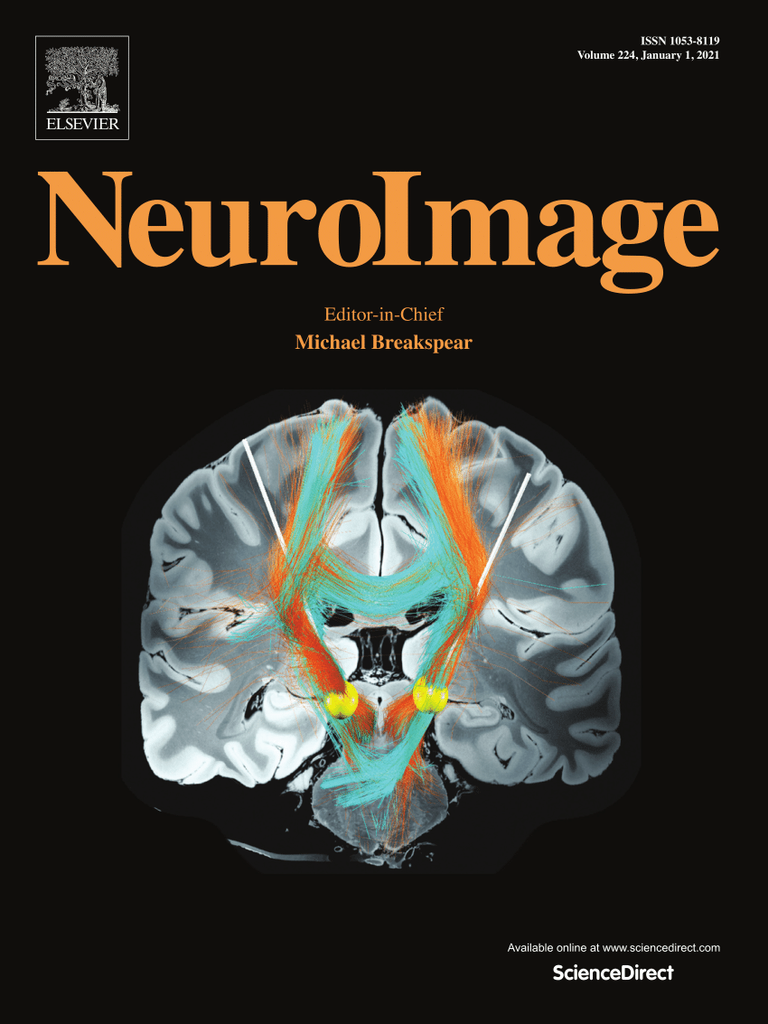 NeuroImage