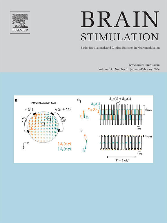 Brain Stimulation